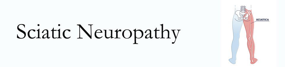 Tonawanda neuropathy pain (sciatica) 